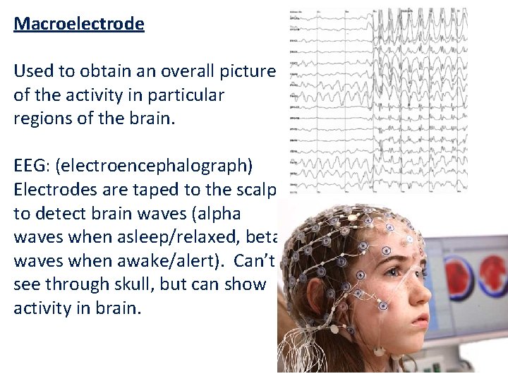 Macroelectrode Used to obtain an overall picture of the activity in particular regions of