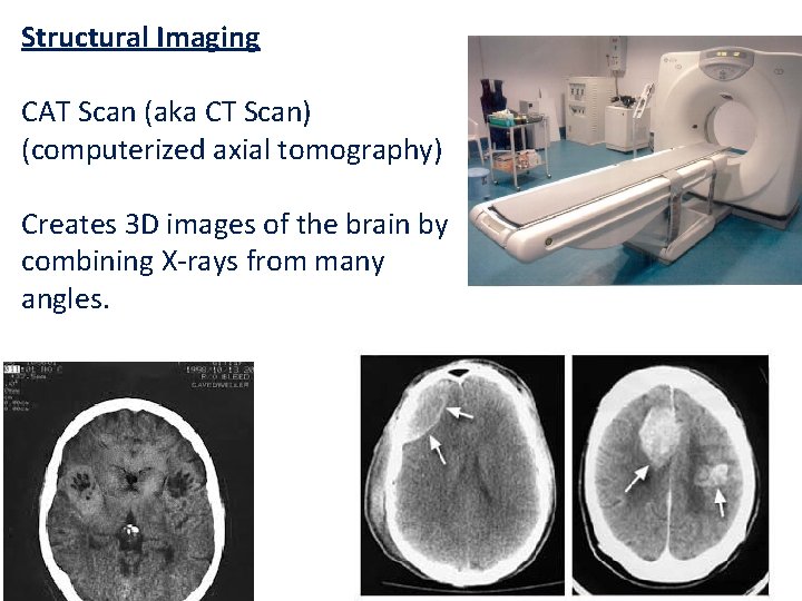 Structural Imaging CAT Scan (aka CT Scan) (computerized axial tomography) Creates 3 D images
