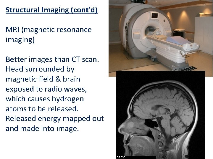 Structural Imaging (cont’d) MRI (magnetic resonance imaging) Better images than CT scan. Head surrounded