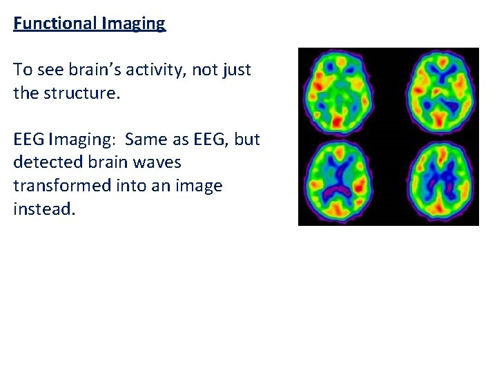 Functional Imaging To see brain’s activity, not just the structure. EEG Imaging: Same as