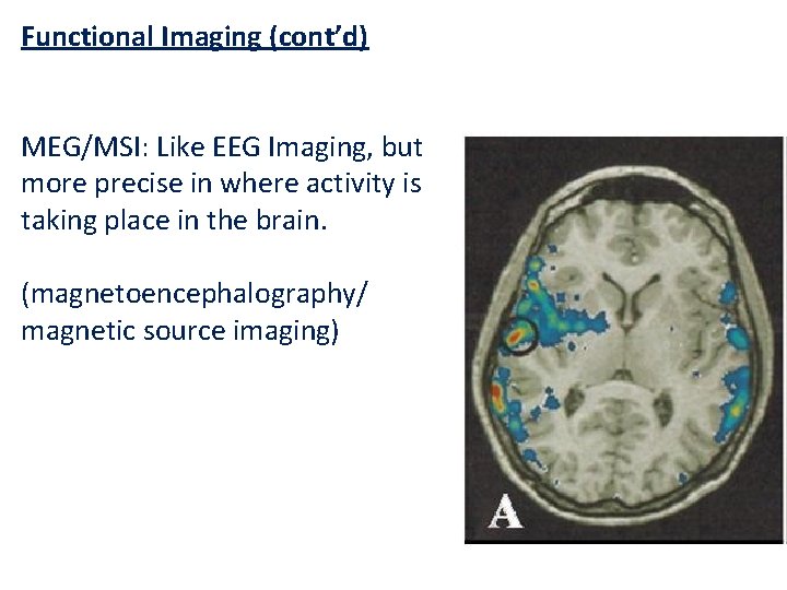Functional Imaging (cont’d) MEG/MSI: Like EEG Imaging, but more precise in where activity is