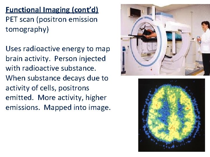 Functional Imaging (cont’d) PET scan (positron emission tomography) Uses radioactive energy to map brain