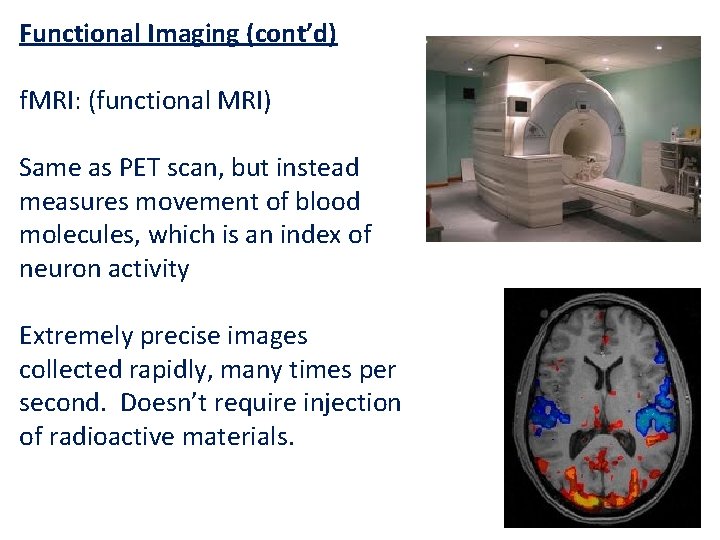 Functional Imaging (cont’d) f. MRI: (functional MRI) Same as PET scan, but instead measures