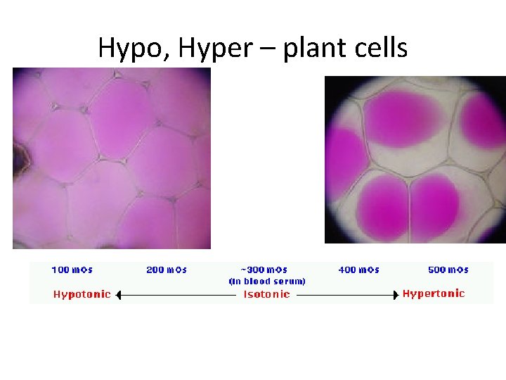 Hypo, Hyper – plant cells 