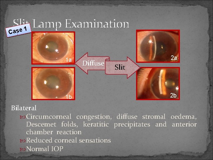 Slit Lamp Examination 1 ase C 1 a 1 b Diffuse 2 a Slit