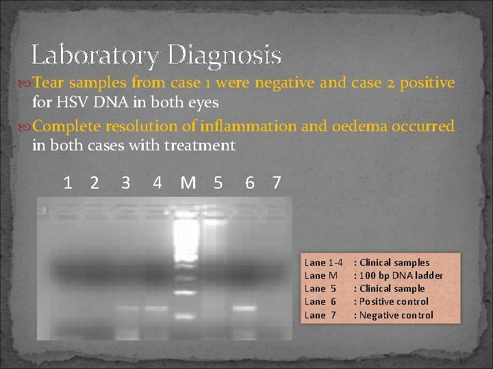Laboratory Diagnosis Tear samples from case 1 were negative and case 2 positive for
