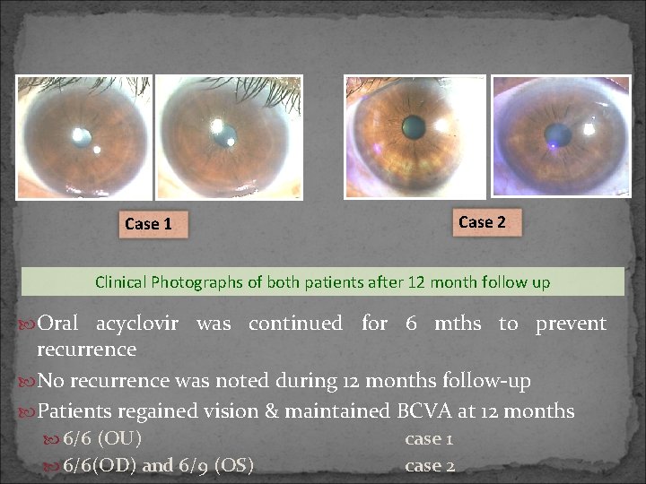 Case 2 Case 1 Clinical Photographs of both patients after 12 month follow up