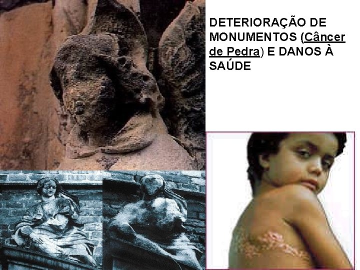 DETERIORAÇÃO DE MONUMENTOS (Câncer de Pedra) E DANOS À SAÚDE 
