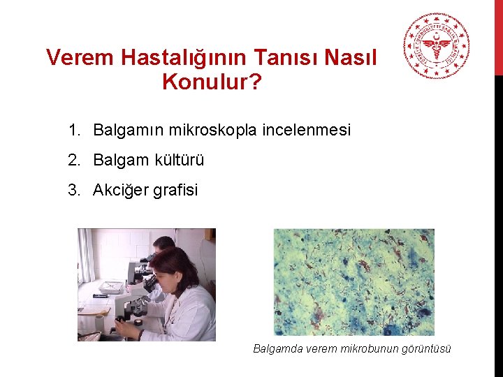 Verem Hastalığının Tanısı Nasıl Konulur? 1. Balgamın mikroskopla incelenmesi 2. Balgam kültürü 3. Akciğer