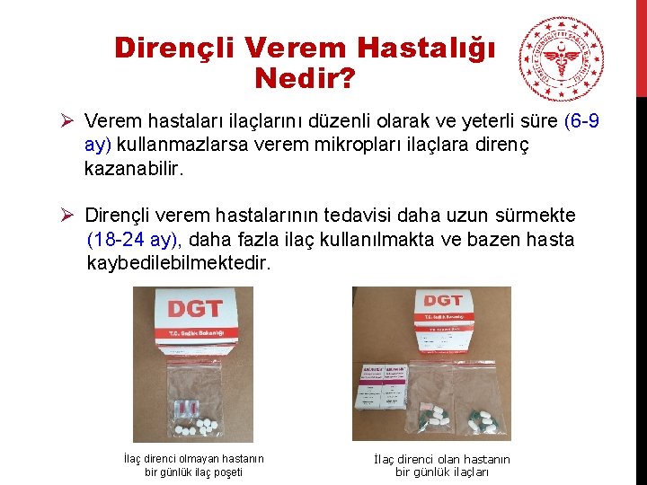 Dirençli Verem Hastalığı Nedir? Ø Verem hastaları ilaçlarını düzenli olarak ve yeterli süre (6