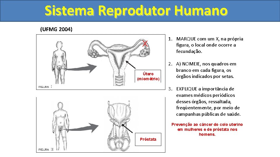 Sistema. Reprodutor. Humano (UFMG 2004) X Útero (miométrio) 1. MARQUE com um X, na