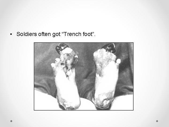  • Soldiers often got “Trench foot”. 