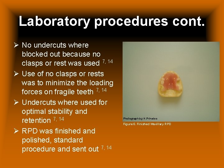 Laboratory procedures cont. Ø No undercuts where blocked out because no clasps or rest