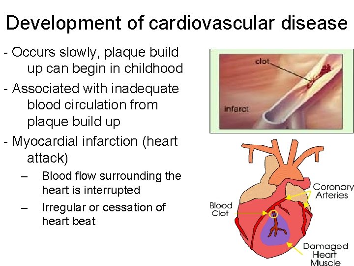 Development of cardiovascular disease - Occurs slowly, plaque build up can begin in childhood