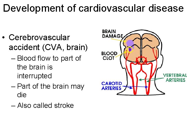 Development of cardiovascular disease • Cerebrovascular accident (CVA, brain) – Blood flow to part