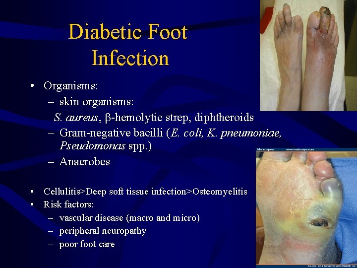 Diabetic Foot Infection • Organisms: – skin organisms: S. aureus, -hemolytic strep, diphtheroids –