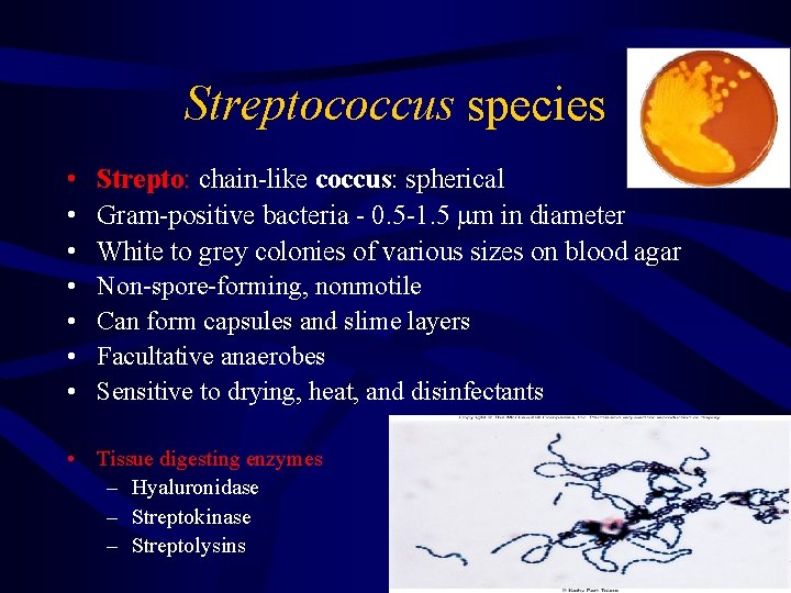 Streptococcus species • • Strepto: chain-like coccus: spherical Gram-positive bacteria - 0. 5 -1.