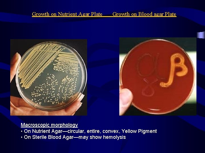 Growth on Nutrient Agar Plate Growth on Blood agar Plate Macroscopic morphology • On