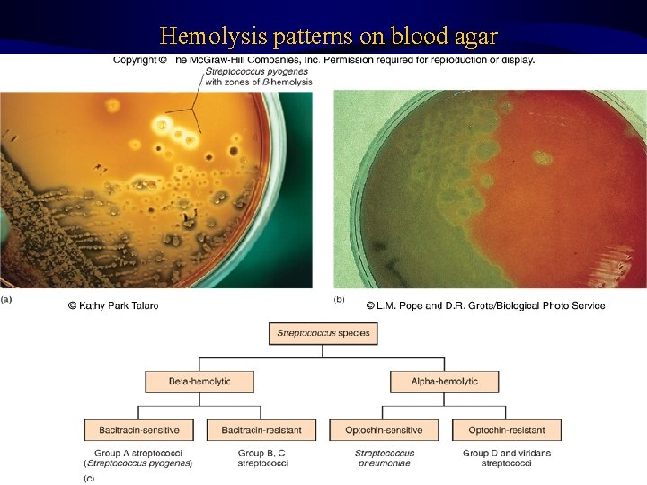 Hemolysis patterns on blood agar 34 