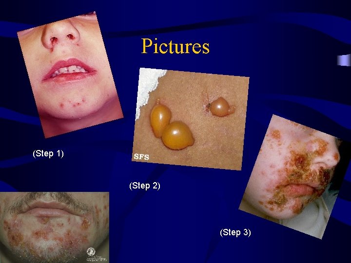 Pictures (Step 1) (Step 2) (Step 3) 