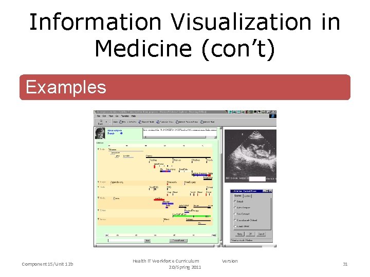 Information Visualization in Medicine (con’t) Examples Component 15/Unit 12 b Health IT Workforce Curriculum
