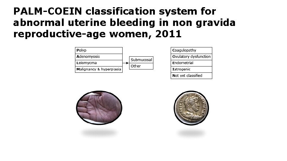 PALM-COEIN classification system for abnormal uterine bleeding in non gravida reproductive-age women, 2011 