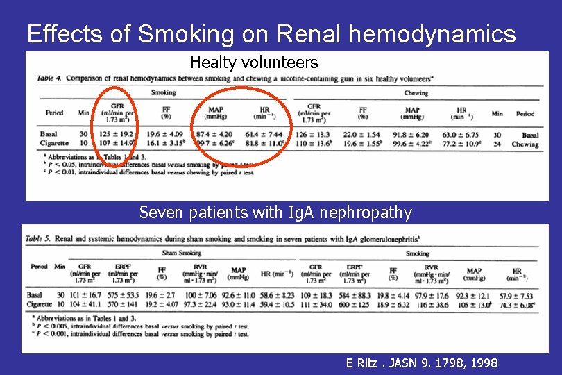 Effects of Smoking on Renal hemodynamics Healty volunteers Seven patients with Ig. A nephropathy
