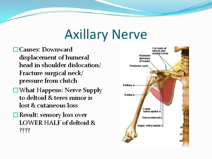 Axillary Nerve �Causes: Downward displacement of humeral head in shoulder dislocation/ Fracture surgical neck/