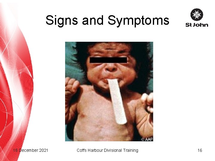 Signs and Symptoms 18 December 2021 Coffs Harbour Divisional Training 16 