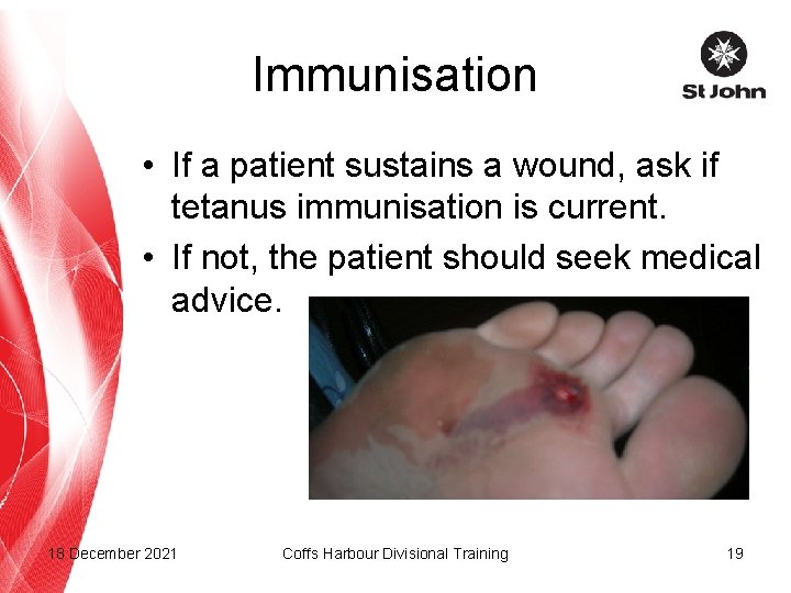 Immunisation • If a patient sustains a wound, ask if tetanus immunisation is current.