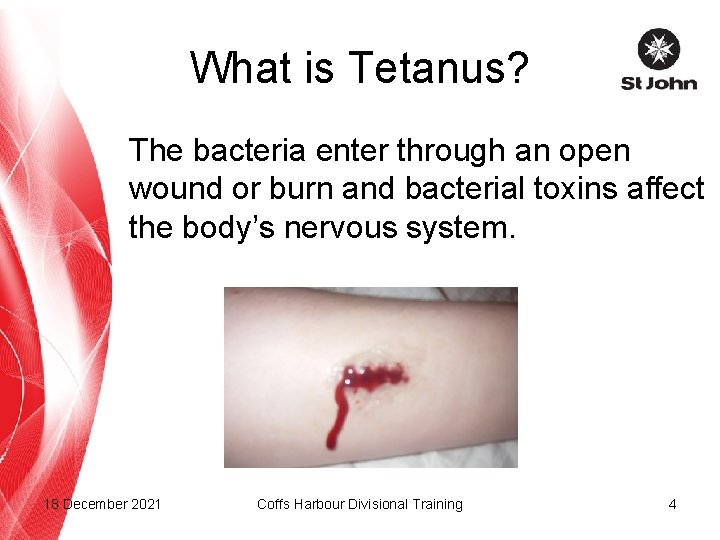 What is Tetanus? The bacteria enter through an open wound or burn and bacterial