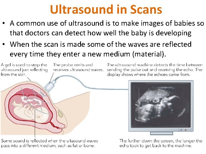 Ultrasound in Scans • A common use of ultrasound is to make images of