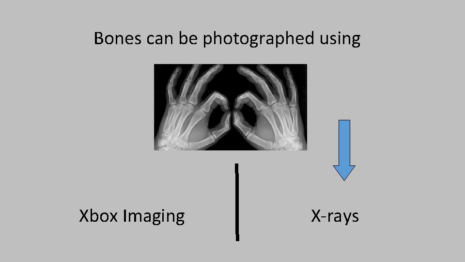 Bones can be photographed using Xbox Imaging X-rays 