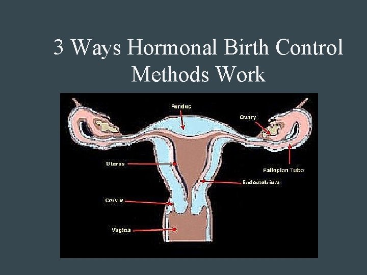 3 Ways Hormonal Birth Control Methods Work 