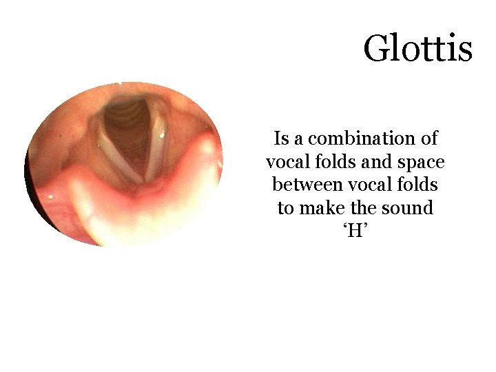 Glottis Is a combination of vocal folds and space between vocal folds to make