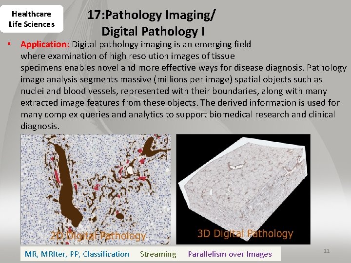 Healthcare Life Sciences 17: Pathology Imaging/ Digital Pathology I • Application: Digital pathology imaging