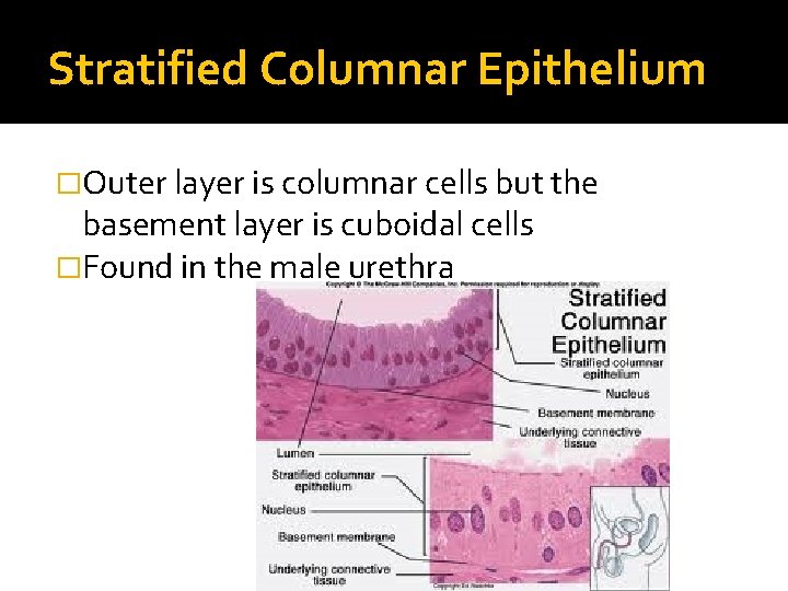 Stratified Columnar Epithelium �Outer layer is columnar cells but the basement layer is cuboidal