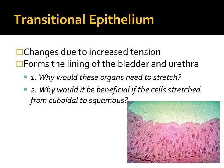 Transitional Epithelium �Changes due to increased tension �Forms the lining of the bladder and