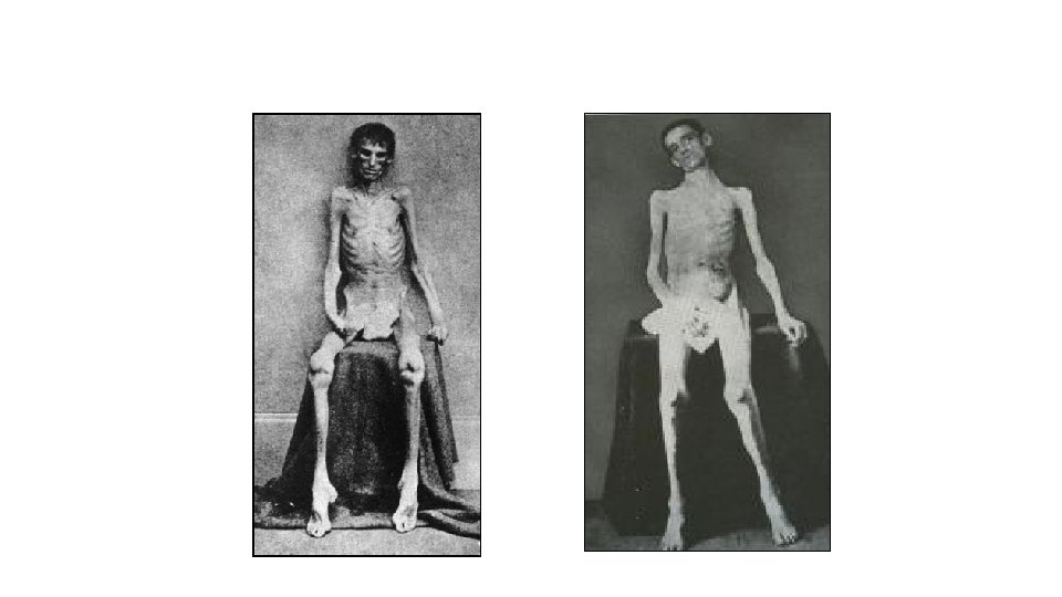 Union “Survivors” 