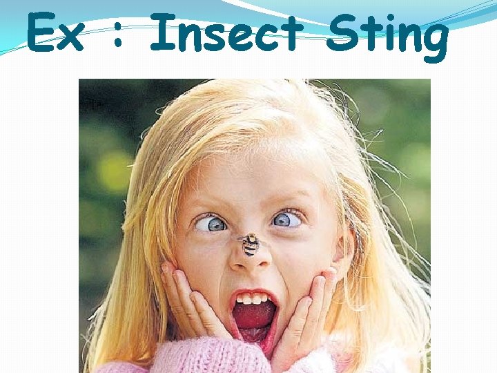 Ex : Insect Sting 
