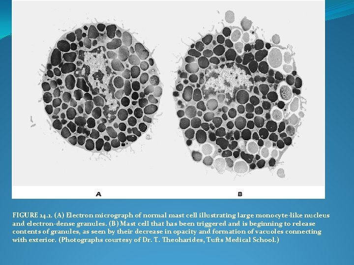 FIGURE 14. 1. (A) Electron micrograph of normal mast cell illustrating large monocyte-like nucleus