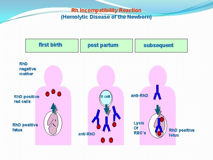 Rh Incompatibility Reaction (Hemolytic Disease of the Newborn) first birth post partum subsequent Rh.
