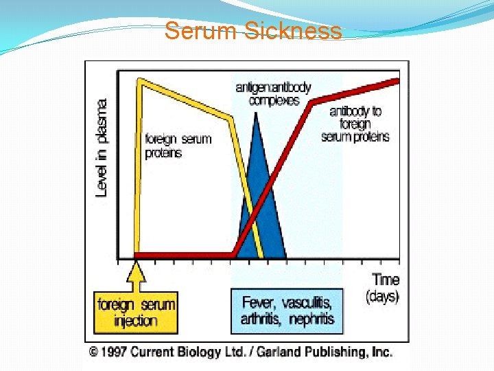 Serum Sickness 