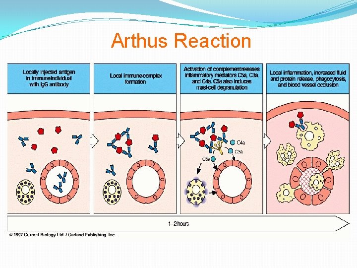Arthus Reaction 