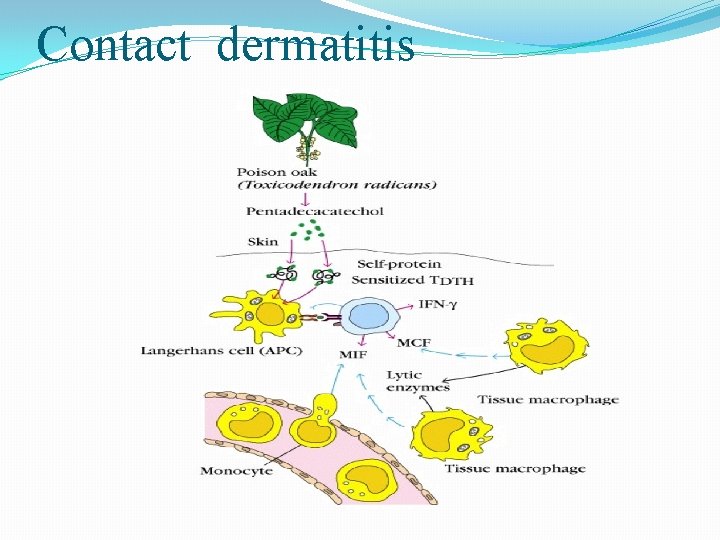 Contact dermatitis 