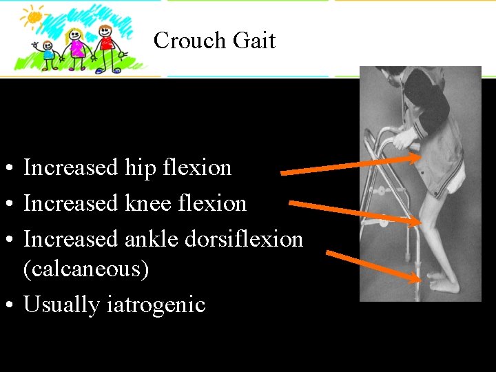 Crouch Gait • Increased hip flexion • Increased knee flexion • Increased ankle dorsiflexion