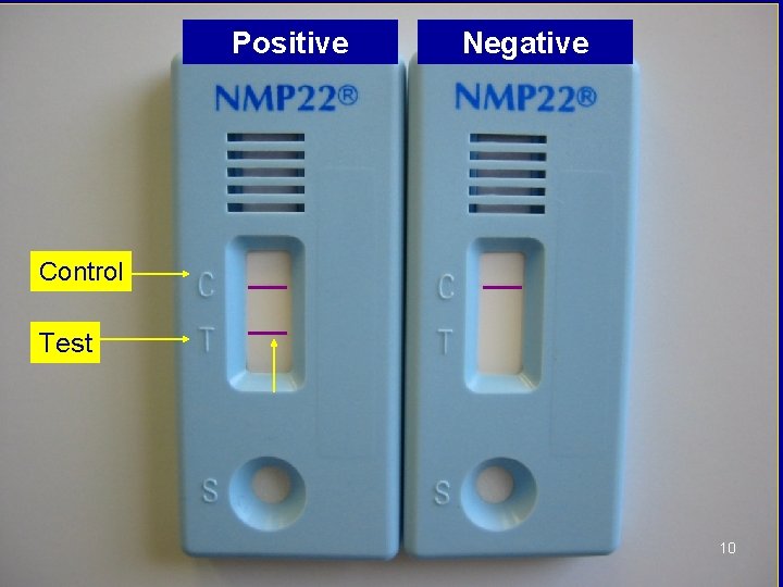 Positive Negative Control Test 10 