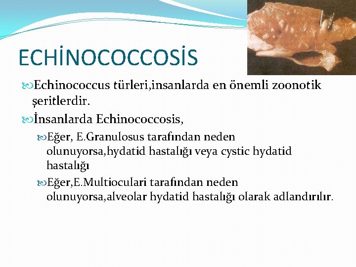ECHİNOCOCCOSİS Echinococcus türleri, insanlarda en önemli zoonotik şeritlerdir. İnsanlarda Echinococcosis, Eğer, E. Granulosus tarafından