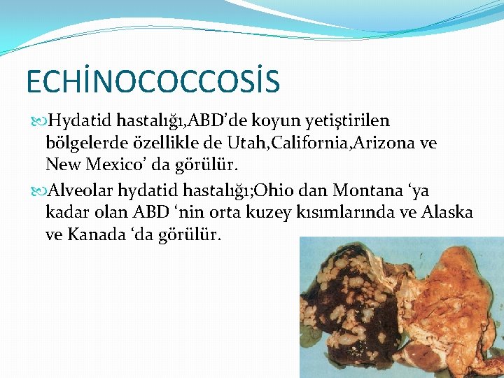 ECHİNOCOCCOSİS Hydatid hastalığı, ABD’de koyun yetiştirilen bölgelerde özellikle de Utah, California, Arizona ve New