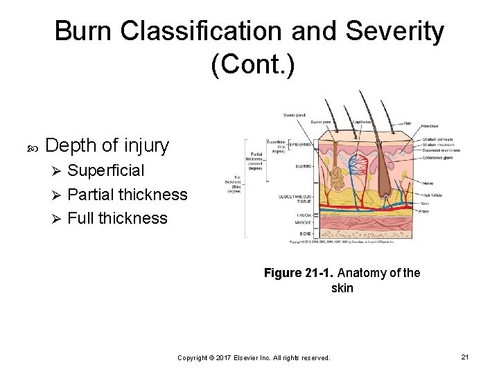Burn Classification and Severity (Cont. ) Depth of injury Superficial Ø Partial thickness Ø